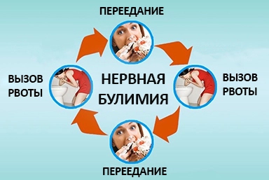 Лечение булимии в Асино